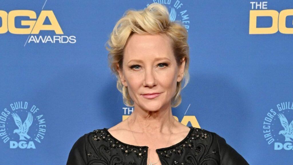 Anne-Heche-brain-injury