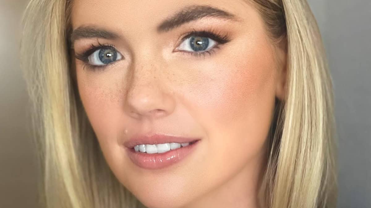 Kate Upton Shamed In Strapless Minidress That's 'Too Small'