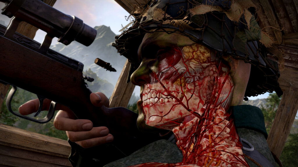 The X-Ray camera reveals the inner anatomy of a soldier's head in Sniper Elite: Resistance