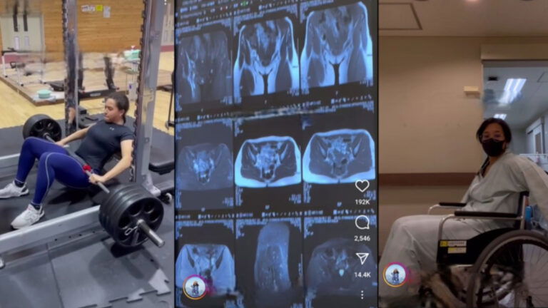 A collage of a woman lifting weights, X-rays showing her broken hip, and her sitting in a wheelchair while she recovers from injuries sustained from a viral gym trend