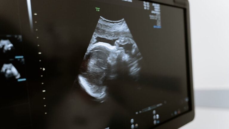 Georgia Abortion Law forces pregnant brain dead woman alive