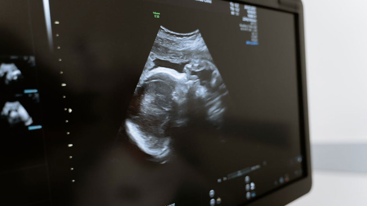 Georgia Doctors Forced to Keep Pregnant Brain Dead Woman Alive Due to Abortion Law: ‘Do We Just Wish for Suffering?’