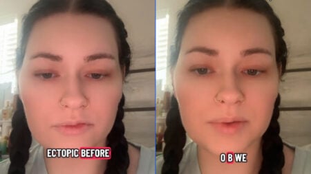 Illinois Doctor’s Personal Feelings Get in the Way of Woman’s Abortion, Now She Can’t Conceive Naturally